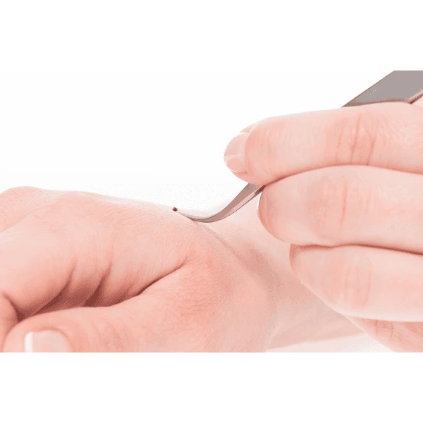 Canal® Tekenpincet Voor Mensen Roestvrij, 11 Cm - Afbeelding 4